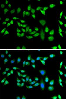 DNAJB6 Antibody - Immunofluorescence analysis of U20S cells.