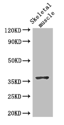 DNAJB6 Antibody - Positive WB detected in:Mouse skeletal muscle tissue;All lanes: DNAJB6 antibody at 2.8ug/ml;Secondary;Goat polyclonal to rabbit IgG at 1/50000 dilution;Predicted band size: 37,27,36,31 kDa;Observed band size: 37 kDa;