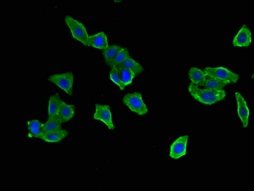 DNAJB6 Antibody - Immunofluorescent analysis of HepG2 cells using DNAJB6 Antibody at a dilution of 1:100 and Alexa Fluor 488-congugated AffiniPure Goat Anti-Rabbit IgG(H+L)