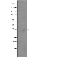DNAJB6 Antibody - Western blot analysis of DNAJB6 expression in U87-MG cells lysate. The lane on the left is treated with the antigen-specific peptide.