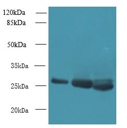 DNAJB8 Antibody - Western blot. All lanes: DNAJB8 antibody at 8 ug/ml. Lane 1: HeLa whole cell lysate. Lane 2: Mouse brain tissue. Lane 3: Mouse liver tissue. Secondary antibody: Goat polyclonal to Rabbit IgG at 1:10000 dilution. Predicted band size: 26 kDa. Observed band size: 26 kDa.