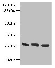 DNAJB8 Antibody - Western blot All lanes: DNAJB8 antibody at 8µg/ml Lane 1: Hela whole cell lysate Lane 2: Mouse brain tissue Lane 3: Mouse liver tissue Secondary Goat polyclonal to rabbit IgG at 1/10000 dilution Predicted band size: 26 kDa Observed band size: 26 kDa