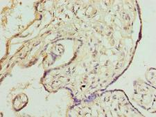 DNAJB8 Antibody - Immunohistochemistry of paraffin-embedded human placenta tissue using DNAJB8 Antibody at dilution of 1:100