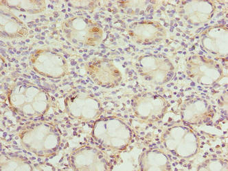 DNAJB8 Antibody - Immunohistochemistry of paraffin-embedded human rectum tissue using DNAJB8 Antibody at dilution of 1:100