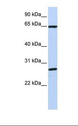 DNAJC1 Antibody - MCF7 cell lysate. Antibody concentration: 1.0 ug/ml. Gel concentration: 12%.  This image was taken for the unconjugated form of this product. Other forms have not been tested.