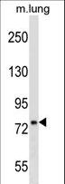 DNAJC10 Antibody - DNAJC10 Antibody western blot of mouse lung tissue lysates (35 ug/lane). The DNAJC10 antibody detected the DNAJC10 protein (arrow).