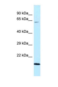 DNAJC11 Antibody - DNAJC11 antibody Western blot of Fetal Heart lysate. Antibody concentration 1 ug/ml.  This image was taken for the unconjugated form of this product. Other forms have not been tested.