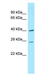 DNAJC11 Antibody - DNAJC11 antibody Western Blot of Mouse Small Intestine.  This image was taken for the unconjugated form of this product. Other forms have not been tested.