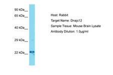 DNAJC12 Antibody -  This image was taken for the unconjugated form of this product. Other forms have not been tested.