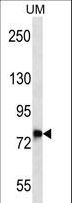 DNAJC14 Antibody - DNAJC14 Antibody western blot of uterus tumor cell line lysates (35 ug/lane). The DNAJC14 antibody detected the DNAJC14 protein (arrow).