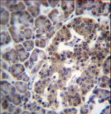DNAJC14 Antibody - DNAJC14 Antibody immunohistochemistry of formalin-fixed and paraffin-embedded human pancreas tissue followed by peroxidase-conjugated secondary antibody and DAB staining.