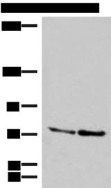 DNAJC14 Antibody - Western blot analysis of A172 and NIH/3T3 cell lysates  using DNAJC14 Polyclonal Antibody at dilution of 1:400