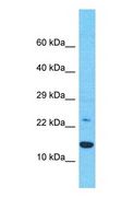 DNAJC15 Antibody - Western blot of DNAJC15 Antibody with Jurkat Whole Cell lysate.  This image was taken for the unconjugated form of this product. Other forms have not been tested.