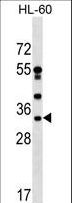 DNAJC17 Antibody - DNAJC17 Antibody western blot of HL-60 cell line lysates (35 ug/lane). The DNAJC17 antibody detected the DNAJC17 protein (arrow).
