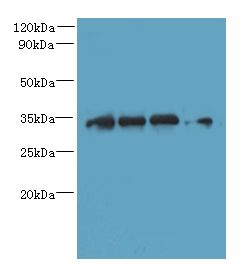 DNAJC17 Antibody - Western blot. All lanes: DNAJC17 antibody at 16 ug/ml. Lane 1: A431 whole cell lysate. Lane 2: HeLa whole cell lysate. Lane 3: Raji whole cell lysate. Lane 4: HepG-2 whole cell lysate. Secondary Goat polyclonal to Rabbit IgG at 1:10000 dilution. Predicted band size: 35 kDa. Observed band size: 35 kDa.