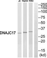 DNAJC17 Antibody - Western blot analysis of extracts from Jurkat cells, HepG2 cells and K562 cells, using DNAJC17 antibody.