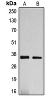 DNAJC17 Antibody - Western blot analysis of DNAJC17 expression in HepG2 (A); SP2/0 (B) whole cell lysates.