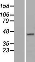DNAJC18 Protein - Western validation with an anti-DDK antibody * L: Control HEK293 lysate R: Over-expression lysate