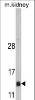 DNAJC19 Antibody - Western blot of DNAJC19 Antibody in mouse kidney tissue lysates (35 ug/lane). DNAJC19 (arrow) was detected using the purified antibody.