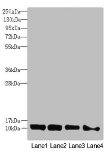 DNAJC19 Antibody - Western blot All Lanes:DNAJC19 antibody at 0.96 ug/ml Lane 1: Mouse kidney tissue Lane 2: A549 whole cell lysate Lane 3: HL60 whole cell lysate Lane 4: Hela whole cell lysate Secondary Goat polyclonal to rabbit IgG at 1/10000 dilution Predicted band size: 13,11 kDa Observed band size: 12 kDa