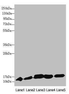 DNAJC19 Antibody - Western blot All Lanes:DNAJC19 antibody at 0.9 ug/ml Lane 1: Mouse lung tissue Lane 2: Mouse kidney tissue Lane 3: A549 whole cell lysate Lane 4: HL60 whole cell lysate Lane 5: Hela whole cell lysate Secondary Goat polyclonal to rabbit IgG at 1/10000 dilution Predicted band size: 13,11 kDa Observed band size: 12 kDa