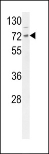 DNAJC2 / ZRF1 Antibody - Western blot of DNAJC2 Antibody in mouse Neuro-2a cell line lysates (35 ug/lane). DNAJC2 (arrow) was detected using the purified antibody.