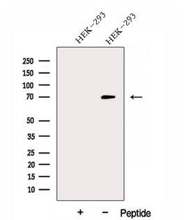 DNAJC21 Antibody - Western blot analysis of extracts of COLO205 cells using DNAJC21 antibody. The lane on the left was treated with blocking peptide.