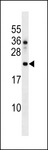 DNAJC24 Antibody - DNAJC24 Antibody western blot of HL-60 cell line lysates (35 ug/lane). The DNAJC24 antibody detected the DNAJC24 protein (arrow).