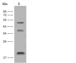 DNAJC24 Antibody - Anti-DNAJC24 rabbit polyclonal antibody at 1:500 dilution. Lane A: U-251 MG Whole Cell Lysate. Lysates/proteins at 30 ug per lane. Secondary: Goat Anti-Rabbit IgG (H+L)/HRP at 1/10000 dilution. Developed using the ECL technique. Performed under reducing conditions. Predicted band size: 17 kDa. Observed band size: 20 kDa.