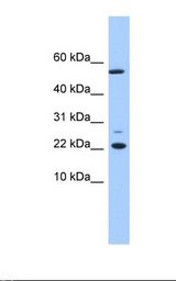 DNAJC24 Antibody - Fetal liver lysate. Antibody concentration: 1.0 ug/ml. Gel concentration: 10-20%.  This image was taken for the unconjugated form of this product. Other forms have not been tested.
