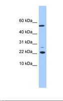 DNAJC24 Antibody - Fetal liver lysate. Antibody concentration: 1.0 ug/ml. Gel concentration: 10-20%.  This image was taken for the unconjugated form of this product. Other forms have not been tested.