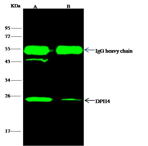 DNAJC24 Antibody - DNAJC24 was immunoprecipitated using: Lane A: 0.5 mg HL-60 Whole Cell Lysate. Lane B: 0.5 mg Raw264.7 Whole Cell Lysate. 4 uL anti-DNAJC24 rabbit polyclonal antibody and 15 ul of 50% Protein G agarose. Primary antibody: Anti-DNAJC24 rabbit polyclonal antibody, at 1:100 dilution. Secondary antibody: Dylight 800-labeled antibody to rabbit IgG (H+L), at 1:5000 dilution. Developed using the odssey technique. Performed under reducing conditions. Predicted band size: 17 kDa. Observed band size: 26 kDa.