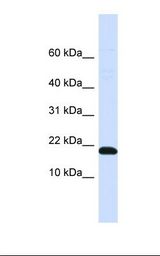 DNAJC25 Antibody - Placenta lysate. Antibody concentration: 1.0 ug/ml. Gel concentration: 10-20%.  This image was taken for the unconjugated form of this product. Other forms have not been tested.