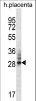 DNAJC27 Antibody - DNAJC27 Antibody western blot of human placenta tissue lysates (35 ug/lane). The DNAJC27 antibody detected the DNAJC27 protein (arrow).