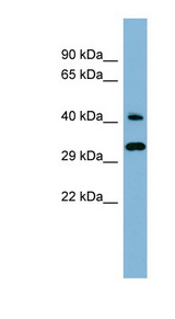 DNAJC27 Antibody - DNAJC27 antibody Western blot of Fetal Kidney lysate. This image was taken for the unconjugated form of this product. Other forms have not been tested.