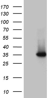 DNAJC27 Antibody - HEK293T cells were transfected with the pCMV6-ENTRY control. (Left lane) or pCMV6-ENTRY DNAJC27. (Right lane) cDNA for 48 hrs and lysed. Equivalent amounts of cell lysates. (5 ug per lane) were separated by SDS-PAGE and immunoblotted with anti-DNAJC27. (1:2000)