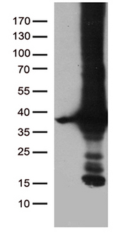 DNAJC27 Antibody - HEK293T cells were transfected with the pCMV6-ENTRY control. (Left lane) or pCMV6-ENTRY DNAJC27. (Right lane) cDNA for 48 hrs and lysed. Equivalent amounts of cell lysates. (5 ug per lane) were separated by SDS-PAGE and immunoblotted with anti-DNAJC27.
