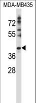 DNAJC28 Antibody - DNAJC28 Antibody western blot of MDA-MB435 cell line lysates (35 ug/lane). The DNAJC28 antibody detected the DNAJC28 protein (arrow).