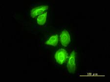 DNAJC3 / p58IPK Antibody - Immunofluorescence of monoclonal antibody to DNAJC3 on HeLa cell. [antibody concentration 10 ug/ml]