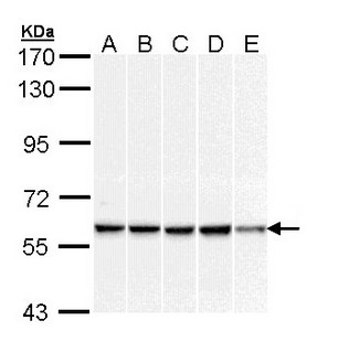 DNAJC3 / p58IPK Antibody - Sample (30 ug of whole cell lysate). A: A431. B: H1299. C: Hela. D: Molt-4. E: Raji. 7.5% SDS PAGE. DNAJC3 antibody diluted at 1:1000. 