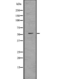 DNAJC3 / p58IPK Antibody - Western blot analysis of DNAJC3 using HuvEc whole lysates.