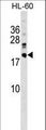 DNAJC30 Antibody - DNAJC30 Antibody western blot of HL-60 cell line lysates (35 ug/lane). The DNAJC30 antibody detected the DNAJC30 protein (arrow).