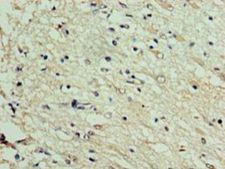 DNAJC30 Antibody - Immunohistochemistry of paraffin-embedded human brain tissue using antibody at 1:100 dilution.  This image was taken for the unconjugated form of this product. Other forms have not been tested.