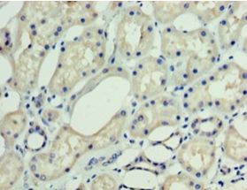 DNAJC30 Antibody - Immunohistochemistry of paraffin-embedded human kidney tissue using antibody at 1:100 dilution.  This image was taken for the unconjugated form of this product. Other forms have not been tested.