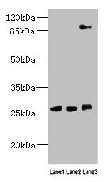 DNAJC30 Antibody - Western blot All lanes: DNAJC30 antibody at 10µg/ml Lane 1: 293T whole cell lysate Lane 2: U87 whole cell lysate Lane 3: SH-SY5Y whole cell lysate Secondary Goat polyclonal to rabbit IgG at 1/10000 dilution Predicted band size: 26 kDa Observed band size: 26, 90 kDa