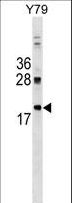DNAJC5 / CSP Antibody - DNAJC5 Antibody western blot of Y79 cell line lysates (35 ug/lane). The DNAJC5 antibody detected the DNAJC5 protein (arrow).