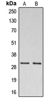 DNAJC5 / CSP Antibody - Western blot analysis of CSP expression in A549 (A); K562 (B) whole cell lysates.