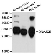 DNAJC5 / CSP Antibody - Western blot analysis of extracts of various cell lines, using DNAJC5 antibody at 1:1000 dilution. The secondary antibody used was an HRP Goat Anti-Rabbit IgG (H+L) at 1:10000 dilution. Lysates were loaded 25ug per lane and 3% nonfat dry milk in TBST was used for blocking. An ECL Kit was used for detection and the exposure time was 90s.