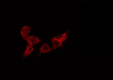DNAJC5 / CSP Antibody - Staining HeLa cells by IF/ICC. The samples were fixed with PFA and permeabilized in 0.1% Triton X-100, then blocked in 10% serum for 45 min at 25°C. The primary antibody was diluted at 1:200 and incubated with the sample for 1 hour at 37°C. An Alexa Fluor 594 conjugated goat anti-rabbit IgG (H+L) Ab, diluted at 1/600, was used as the secondary antibody.