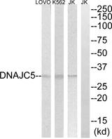 DNAJC5 / CSP Antibody - Western blot analysis of extracts from Jurkat, K562 and LOVOO cells, using DNAJC5 antibody.